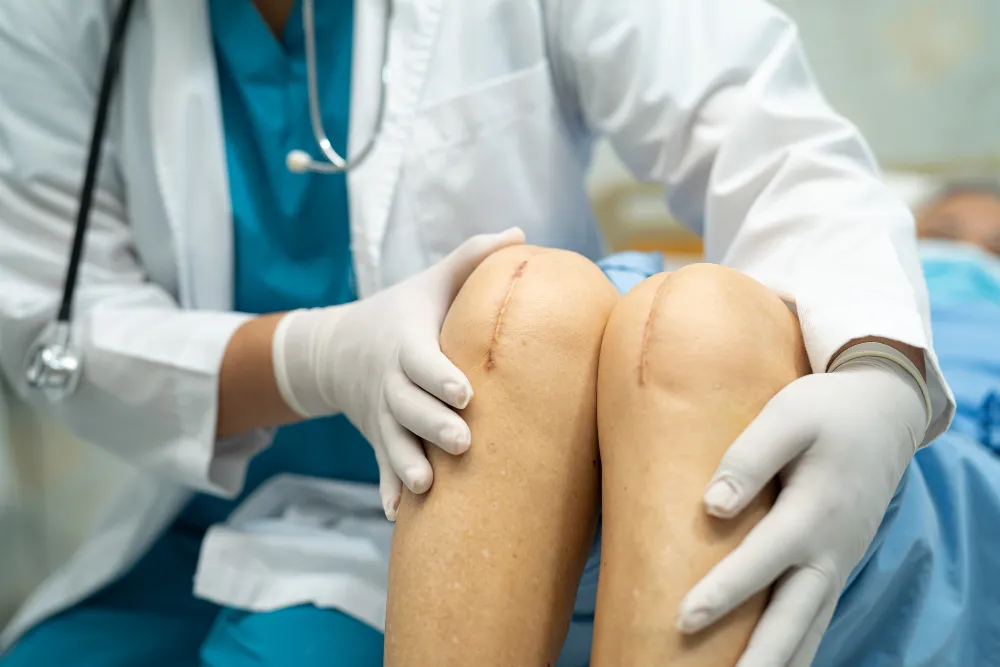 Knee Replacement Surgery: , estoring Mobility best knee replacement surgeon in indore, knee replacement surgeon in indore, best knee replacement hospital in indore, knee replacement doctor in indore