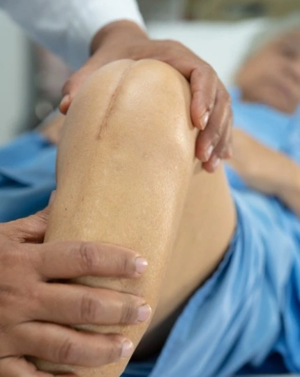 best partial knee replacement surgery in indore, partial knee replacement surgery indore