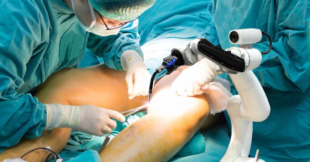 knee replacement surgeon in indore