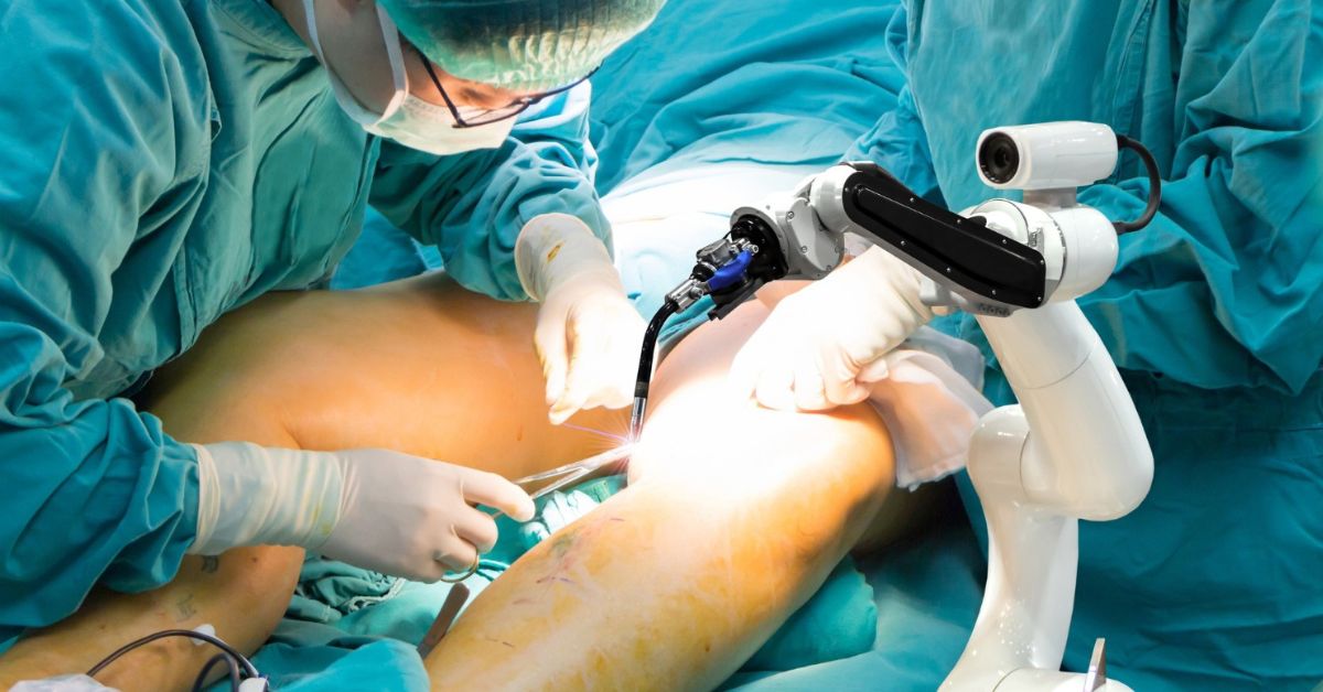 knee replacement surgeon in indore