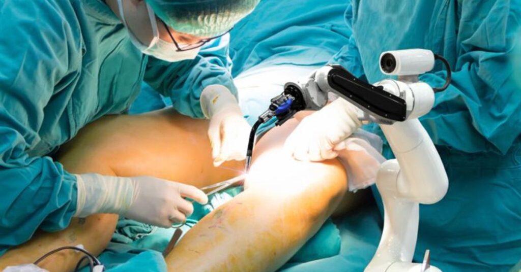 knee replacement surgery in indore