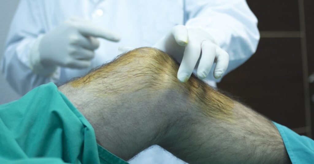 knee transplant surgeon in indore
