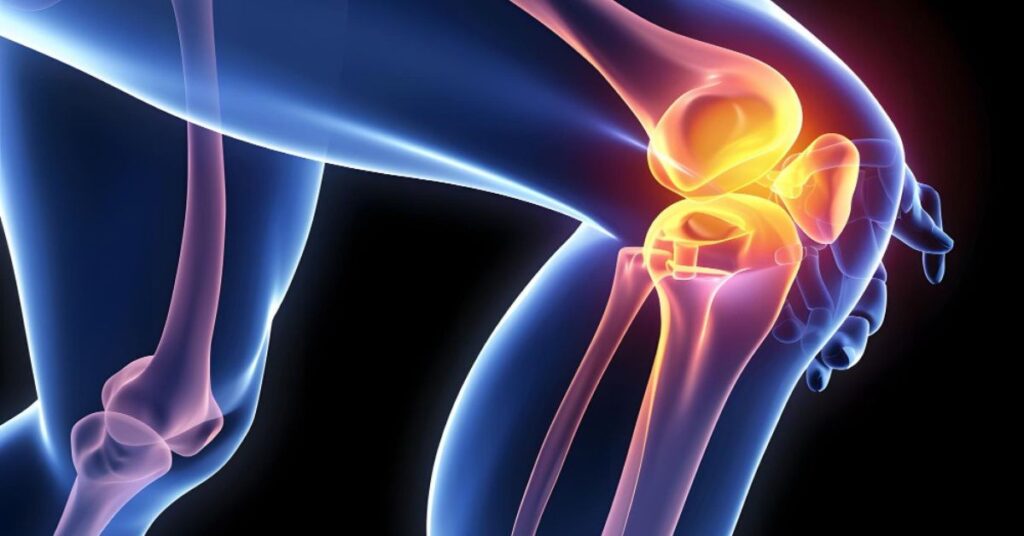 Knee Specialist in indore