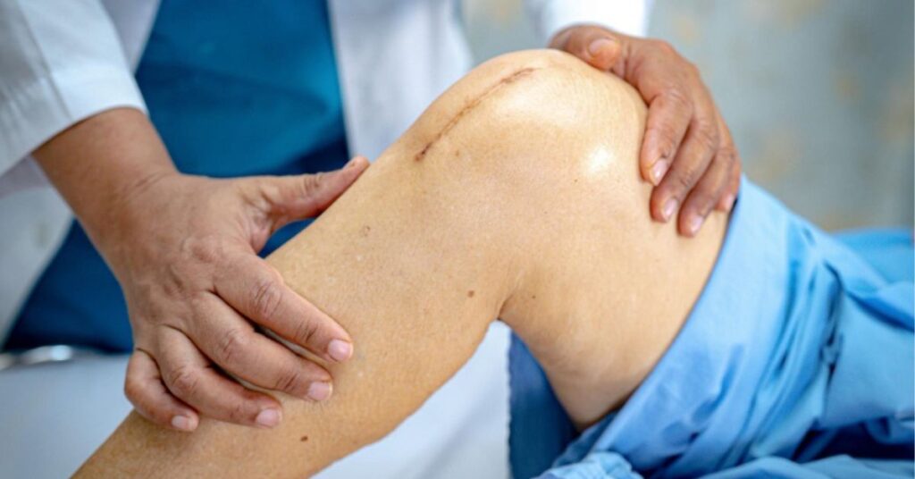 restore knee strength, best orthopedic surgeon in indore
