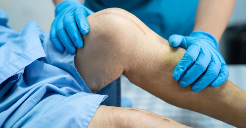 knee replacement surgery in indore